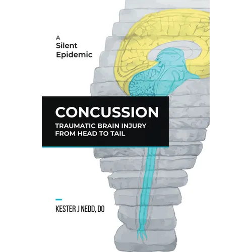 Hardcover book with illustrated head-and-brain cover and title "CONCUSSION"