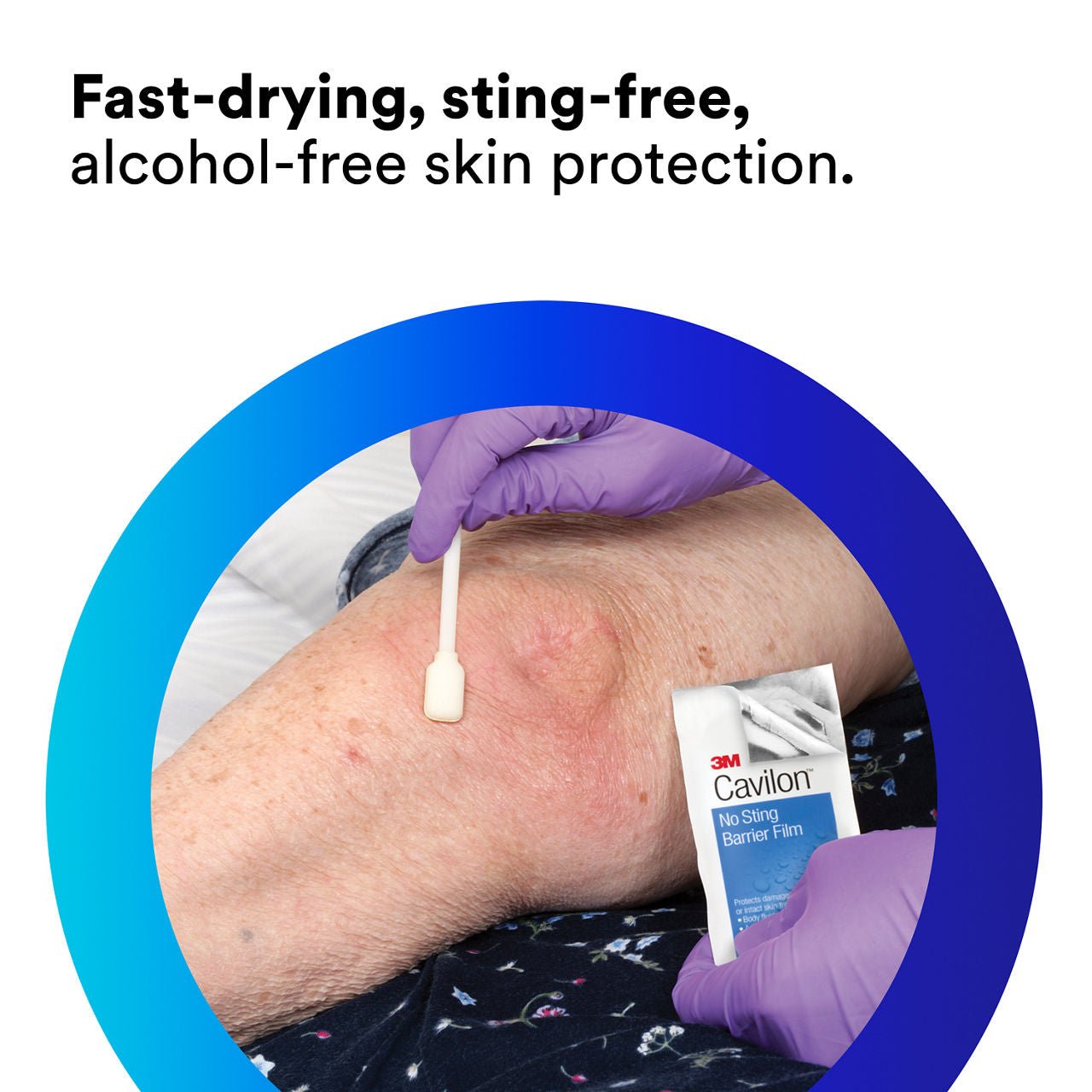 Barrier film application on skin with small white applicator, gloved hand
