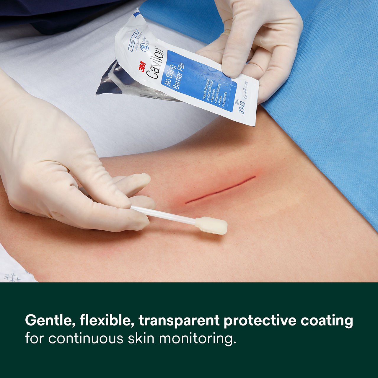 Barrier film applied to forearm; gloved hands hold No Sting Barrier Film packet