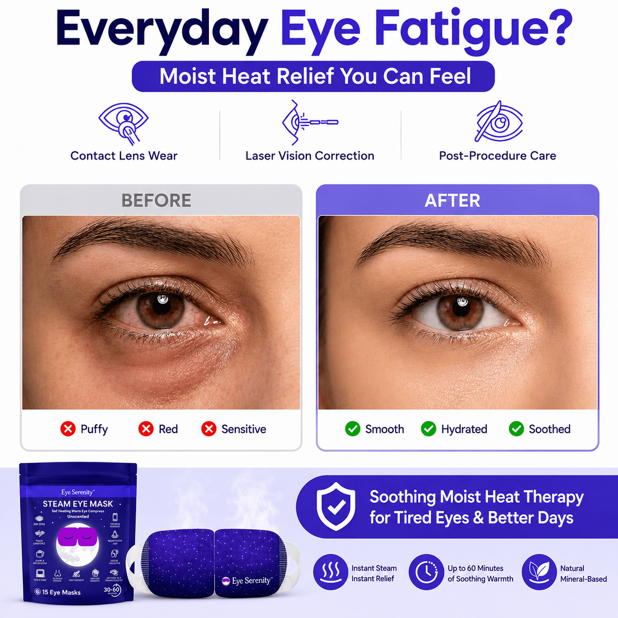 Eye Serenity Steam Eye Mask - Self-Heating Warm Eye Compress for Dry Eyes, Puffiness, Sleep & Travel Lure Essentials