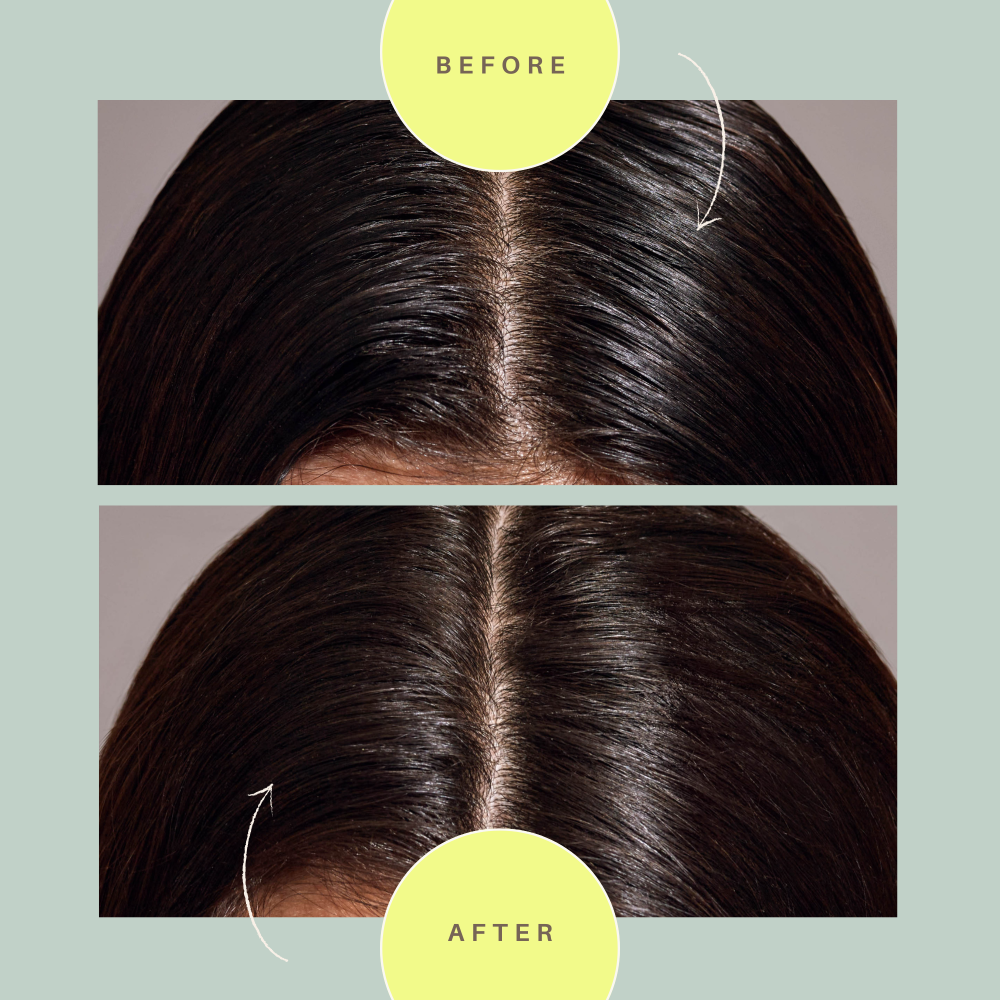 Hair brush product showing before-and-after hair strands and central scalp parting