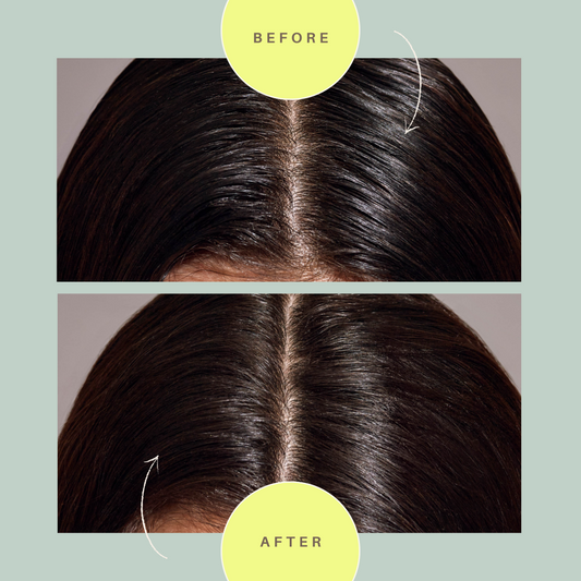 Hair brush product showing before-and-after hair strands and central scalp parting