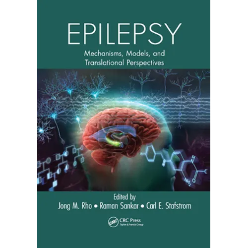 Epilepsy book, paperback cover with brain, circuits, and title text