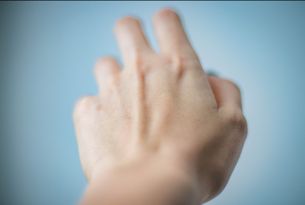 Close up of hand reaching towards a blue background showing pain