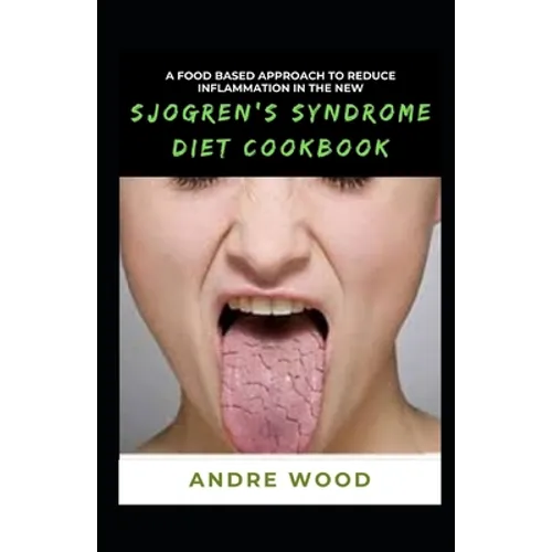 A Food Based Approach To Reduce Inflammation In The New Sjogren's Syndrome Diet Cookbook - Paperback Books by splitShops