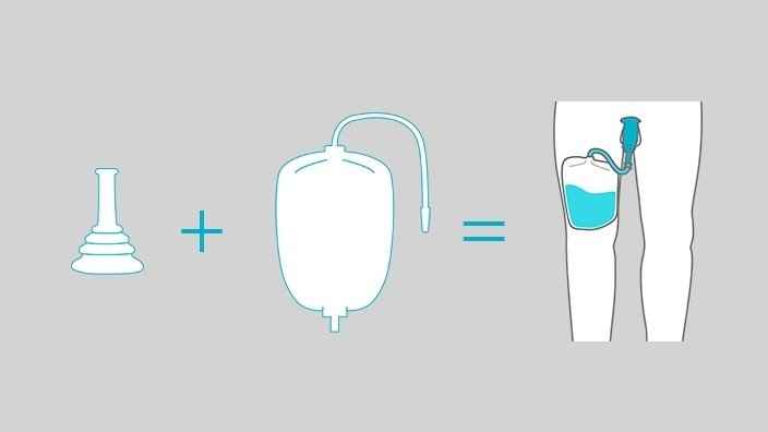 Diagram of leg urine bag setup with tubing connected to a leg