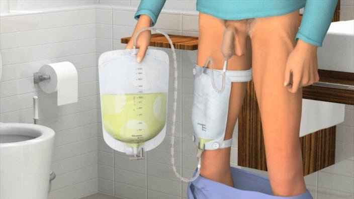 Nighttime urine bag with tubing, worn on leg using a strap