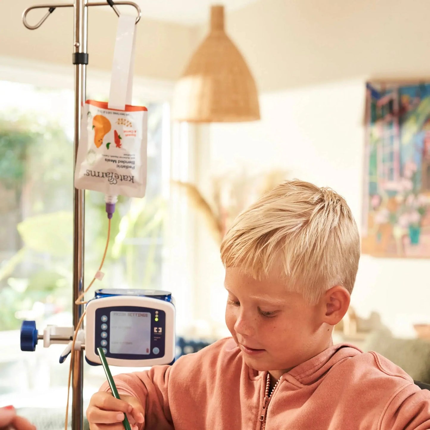 Boy with tube feeding using pediatric blended meals squash & carrot pouch